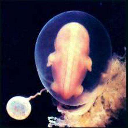 Эмбрион умеет выражать свои эмоции