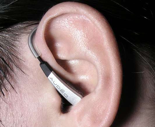 Phonak Audeo