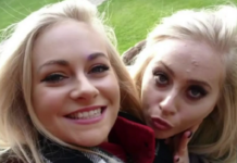 Сестри витратили 14 мільйонів рублів на операції і стали не відрізняються один від одного